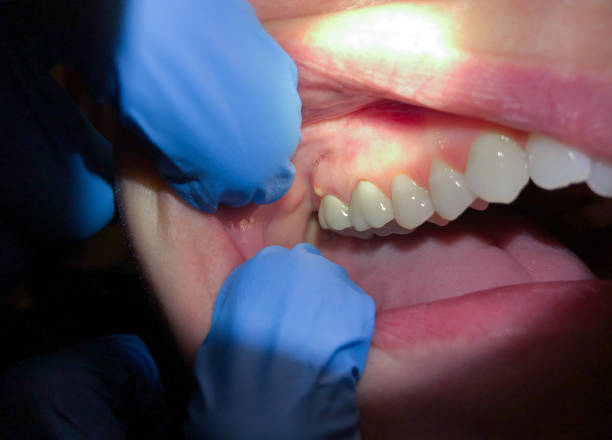 Best Emergency Cosmetic Dentistry in Salem, SD